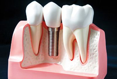 ��ֲ���ص�