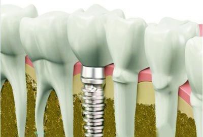 ��ֲ�����ŵ�