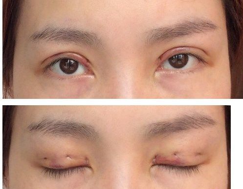 ��ʽ����˫��Ƥ