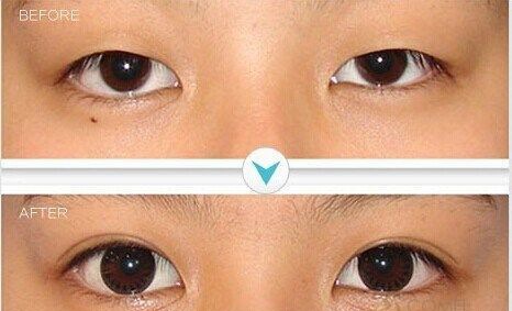 �����۸�