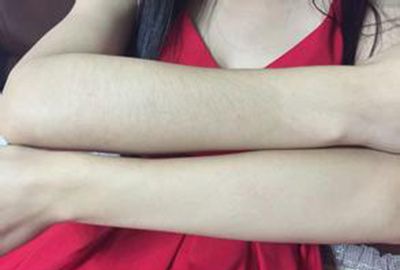 Ůʿ��ë��ԭ��