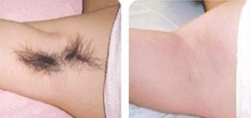 Ůʿ��ë�ķ���