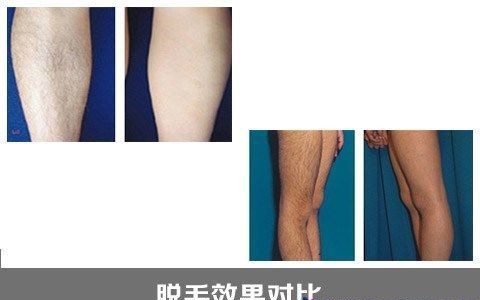 ������ë